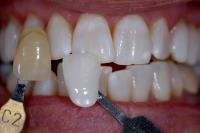 Sewell Dental Designs image 5